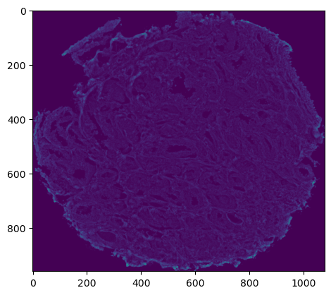 _images/01_HDI_IMC_Preprocessing_15_1.png