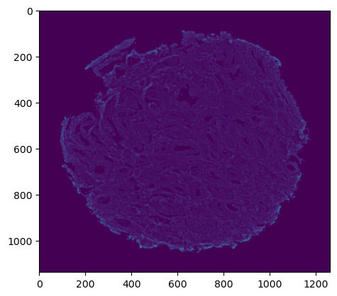 _images/01_HDI_IMC_Preprocessing_8_0.png